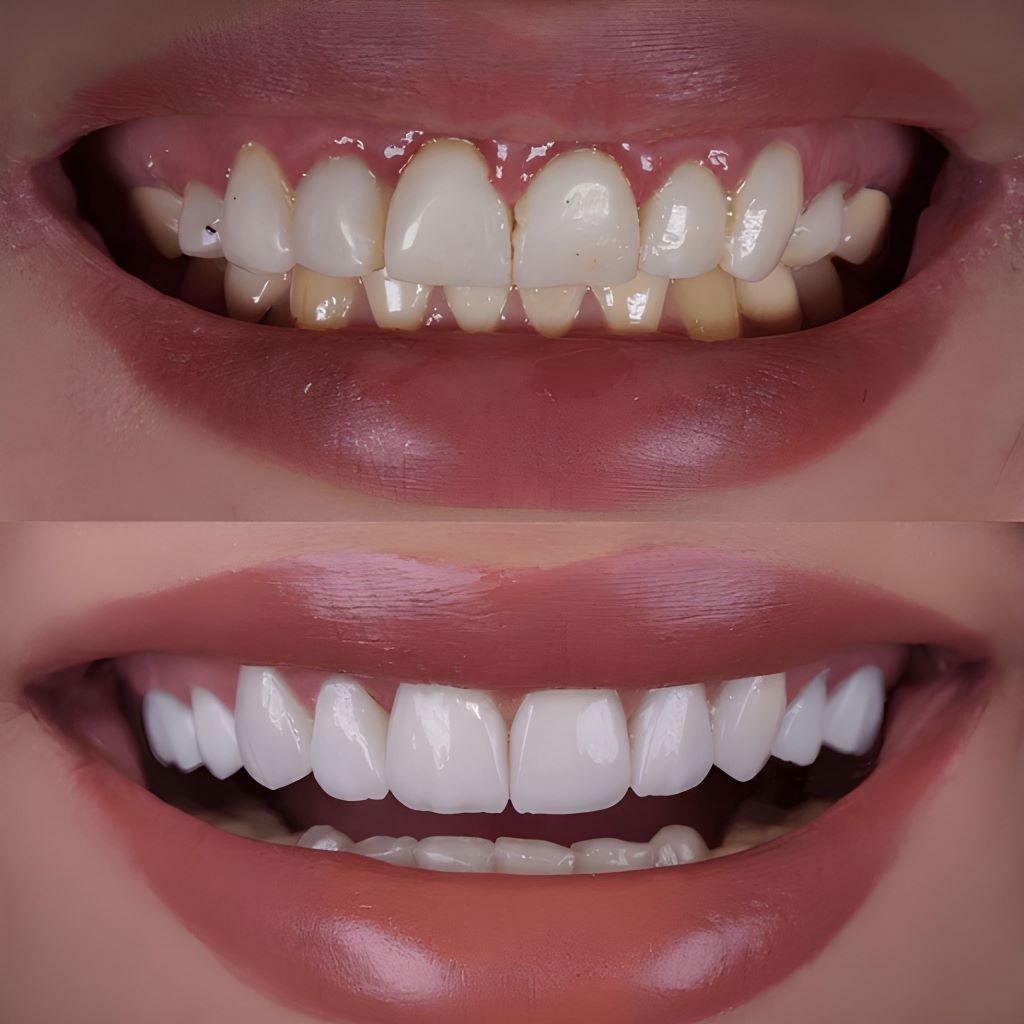 esthetic dentistry near you